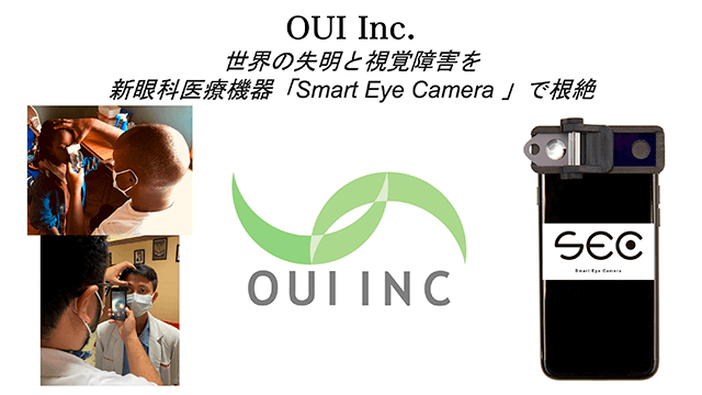 Photo:Smart Eye Camera